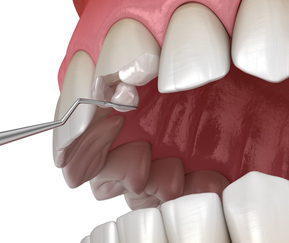 Restorative Dentistry